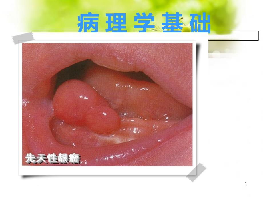 第1页