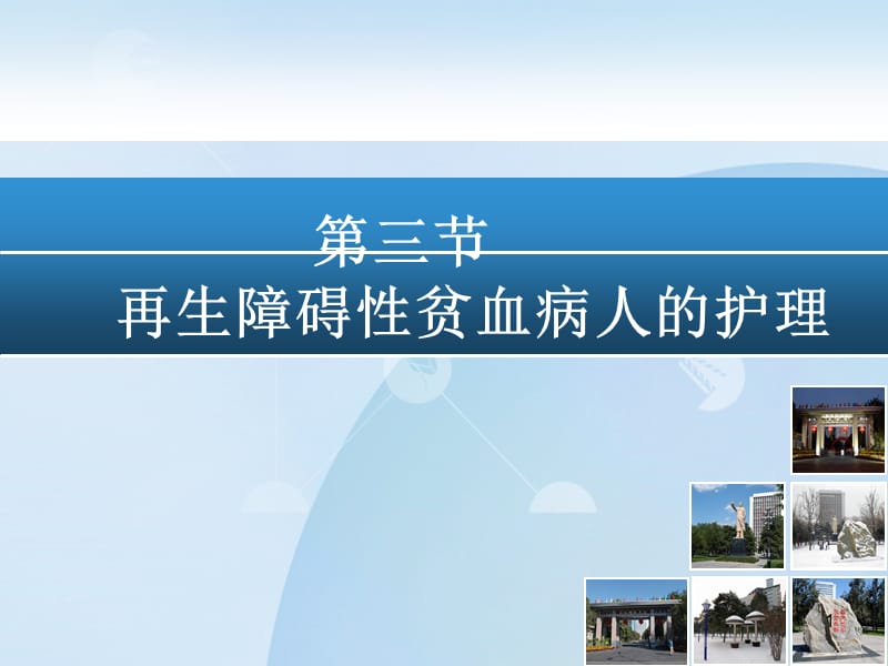 再生障碍性贫血病人的护理ppt课件.ppt_第1页
