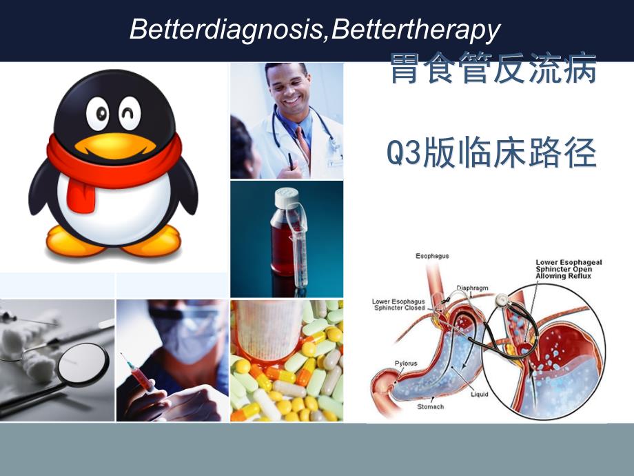 李医生GERD病例演讲比赛获奖_第1页